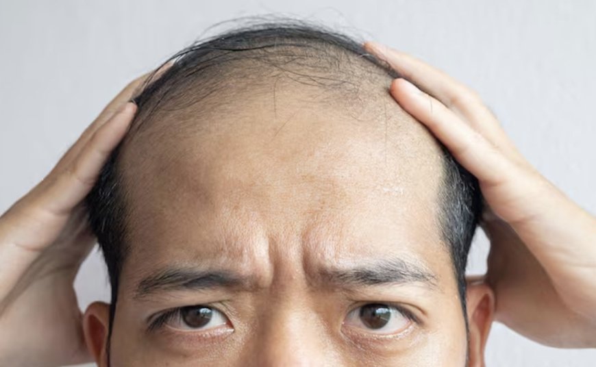 پسپۆڕانی ئەمریکی: لەڕێگەی دەرمانێکەوە کێشەی کەچەڵی بنبڕ دەکەین