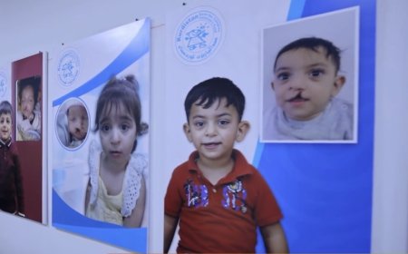 تیمێکی جیهانی: لە هەرێمی کوردستان بەخۆڕایی نەشتەرگەریی قڵیشی لێو و مەڵاشووی 50 بۆ 60 منداڵ دەکەین