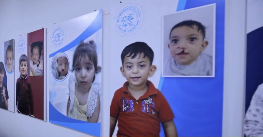 تیمێکی جیهانی: لە هەرێمی کوردستان بەخۆڕایی نەشتەرگەریی قڵیشی لێو و مەڵاشووی 50 بۆ 60 منداڵ دەکەین